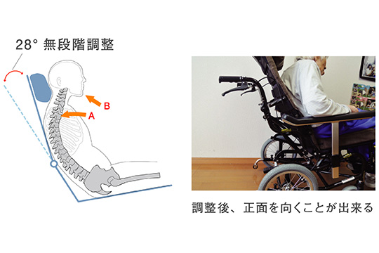 背シート調整